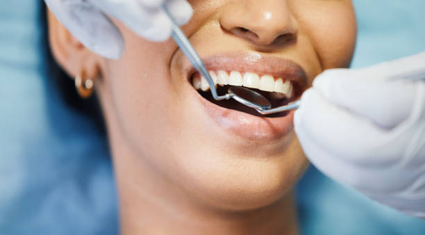 Best Urgent Care for Lost Fillings or Crowns in Hallsville, TX