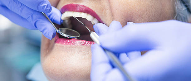 Best Same-Day Emergency Dental Services in Hallsville, TX