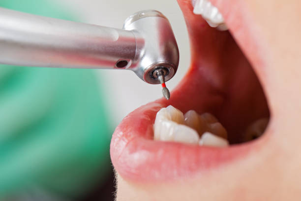 Best Emergency Dental Care for Broken or Chipped Teeth in Hallsville, TX